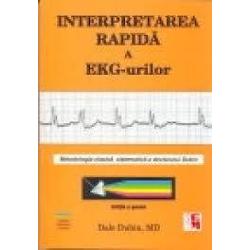 Interpretarea rapida a EKG urilor