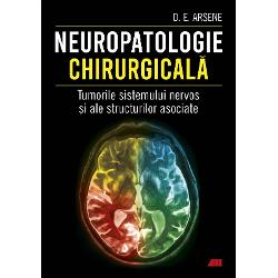 Neuropatologie chirurgicala. Tumorile sistemului nervos si ale structurilor asociate imagine librarie clb