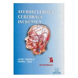 Ateroscleroza cerebrala ischemica imagine 2022