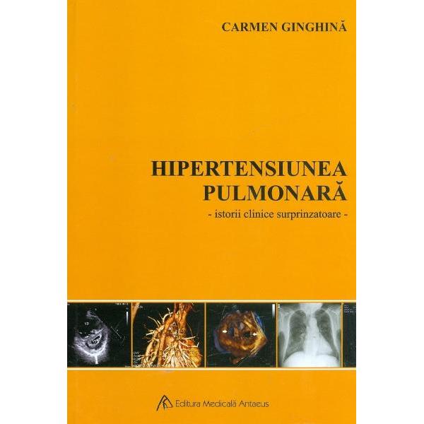 Hipertensiunea pulmonar&259; – subiect de carte – iat&259; ce aduce nou acest Congres de Cardiologie  Hipertensiunea pulmonar&259; a ajuns un subiect modern mai ales acum în lumina noilor tratamente activespan 